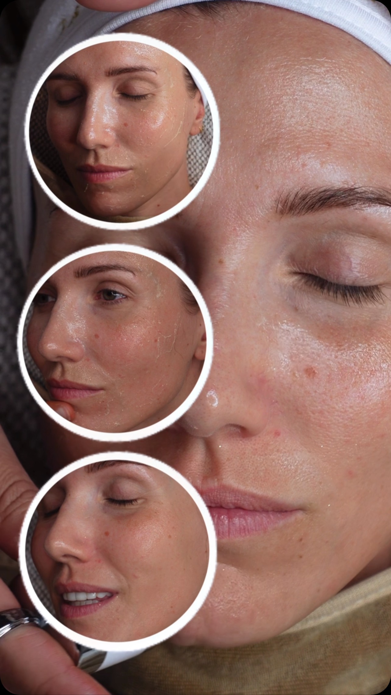 Aloe vera skincare