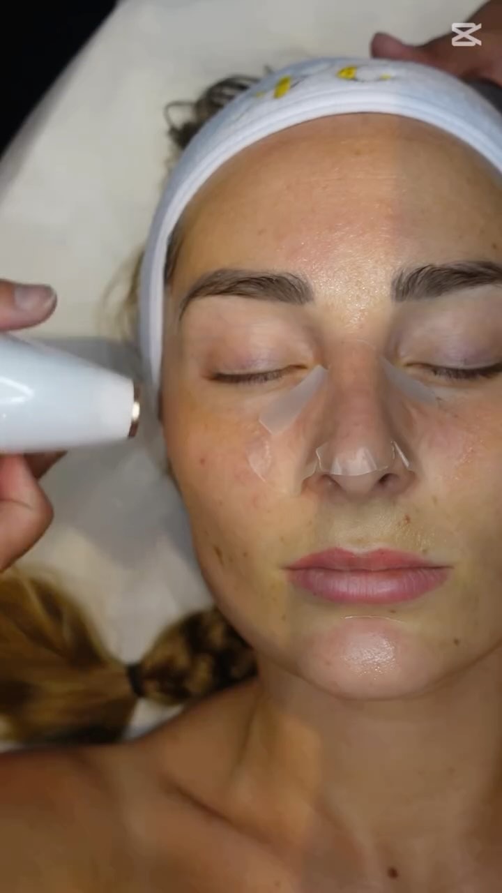 Facial treatment